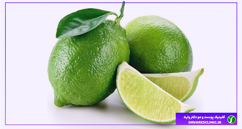 درمان شوره سر با آب لیمو